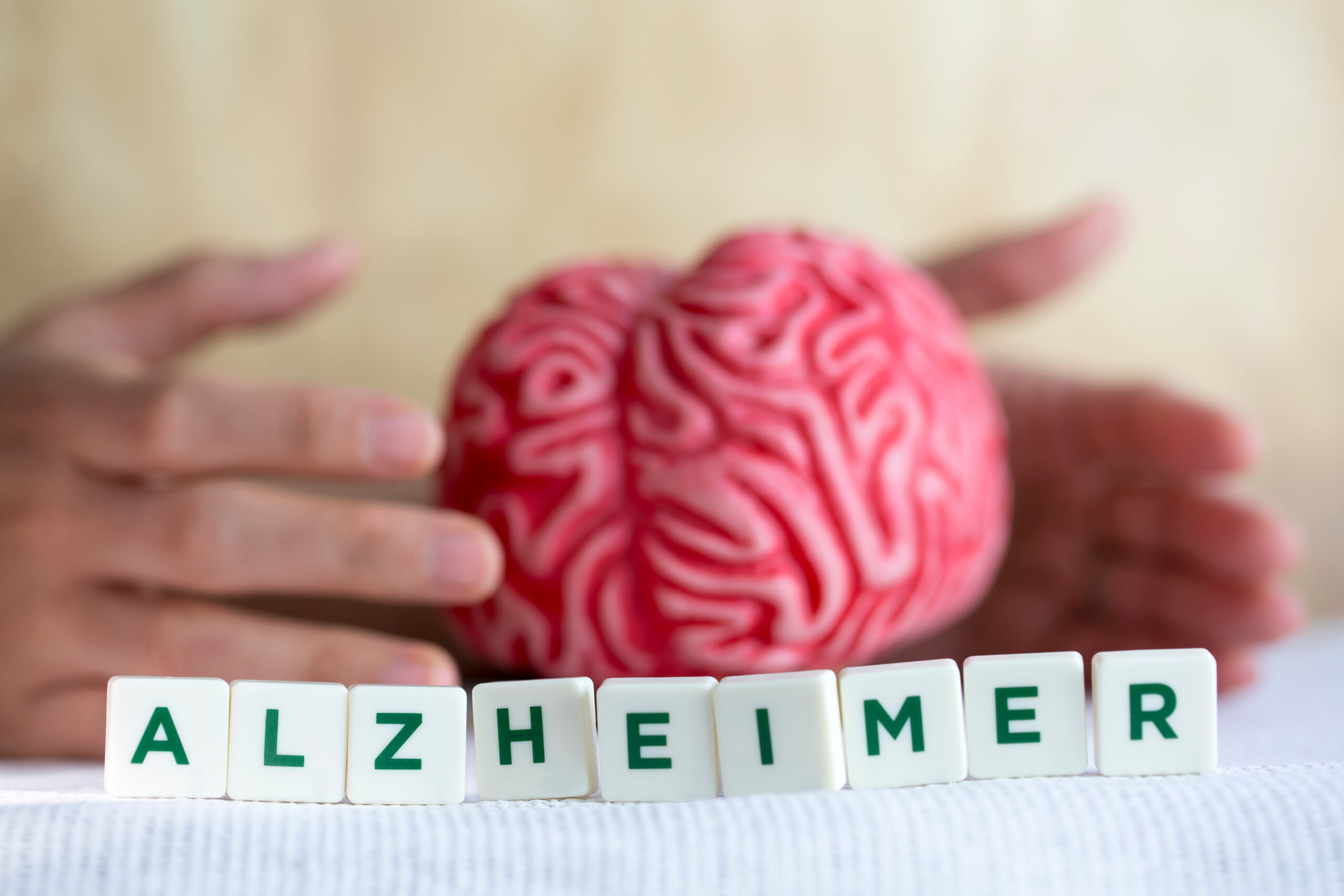 'Donanemab': medicamento reduz a progressão do Alzheimer em até 60%