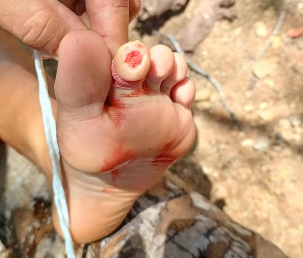 Banhistas são atacados por piranhas em rio no interior do Rio Grande do Norte — Foto: Cedida / Redes Sociais

