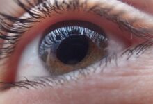 Sono ruim aumenta em até 20% risco de glaucoma, diz estudo